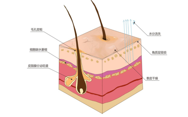 私密毛发移植