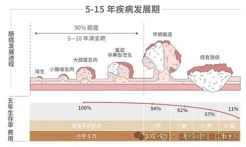 赤峰恩星胃肠知识科普：无痛肠镜会很难受吗？是时候改变下观念了！